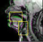 Interpreting ‘noise’ in the data: A comparative study of two contemporary music singers