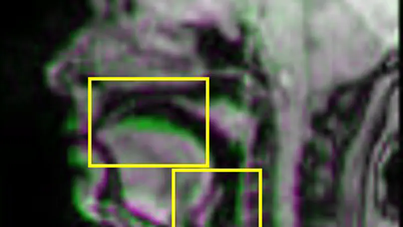 Interpreting ‘noise’ in the data: A comparative study of two contemporary music singers