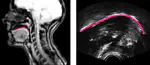 The articulation of dark /l/ by L2 speakers of English: Insights from Magnetic Resonance Imaging and Ultrasound Tongue Imaging