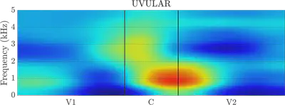 uvular